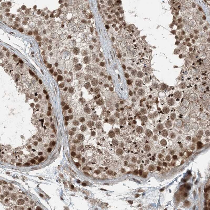 Immunohistochemistry-Paraffin TTC15 Antibody - BSA Free
