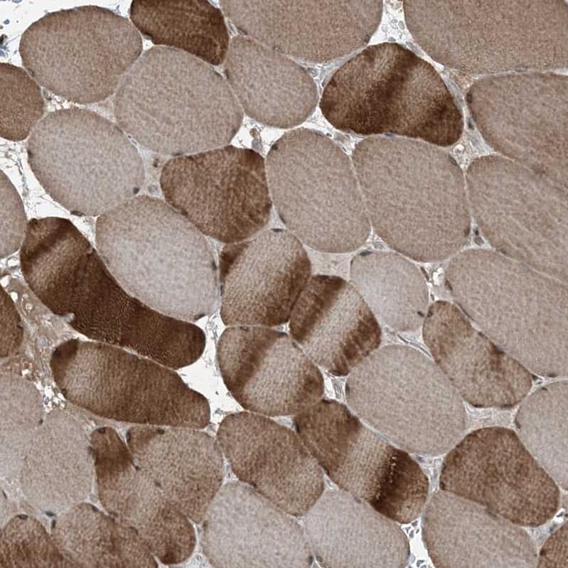 Staining of human skeletal muscle shows strong nuclear cytoplasmic positivity in myocytes.