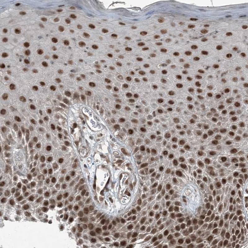 Staining of human skin shows strong nuclear-cytoplasmic positivity in squamous epithelial cells.