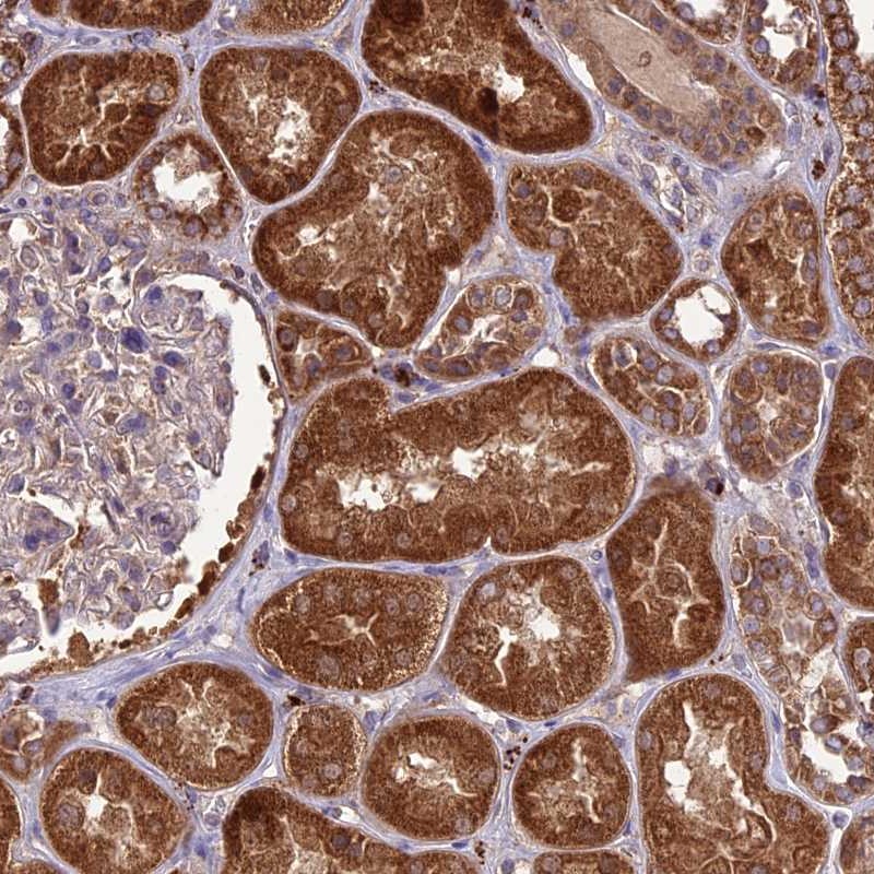 Immunohistochemistry-Paraffin NDUFAF1 Antibody - BSA Free