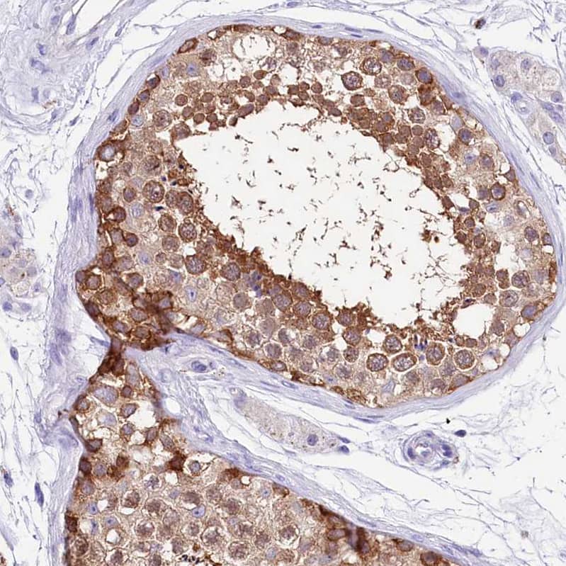 Staining of human testis shows moderate cytoplasmic positivity in cells in seminiferous ducts.