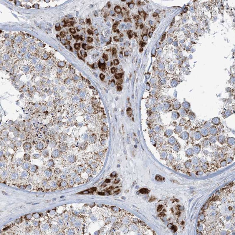 Staining of human testis shows strong  cytoplasmic granular positivity in Leydig cells.