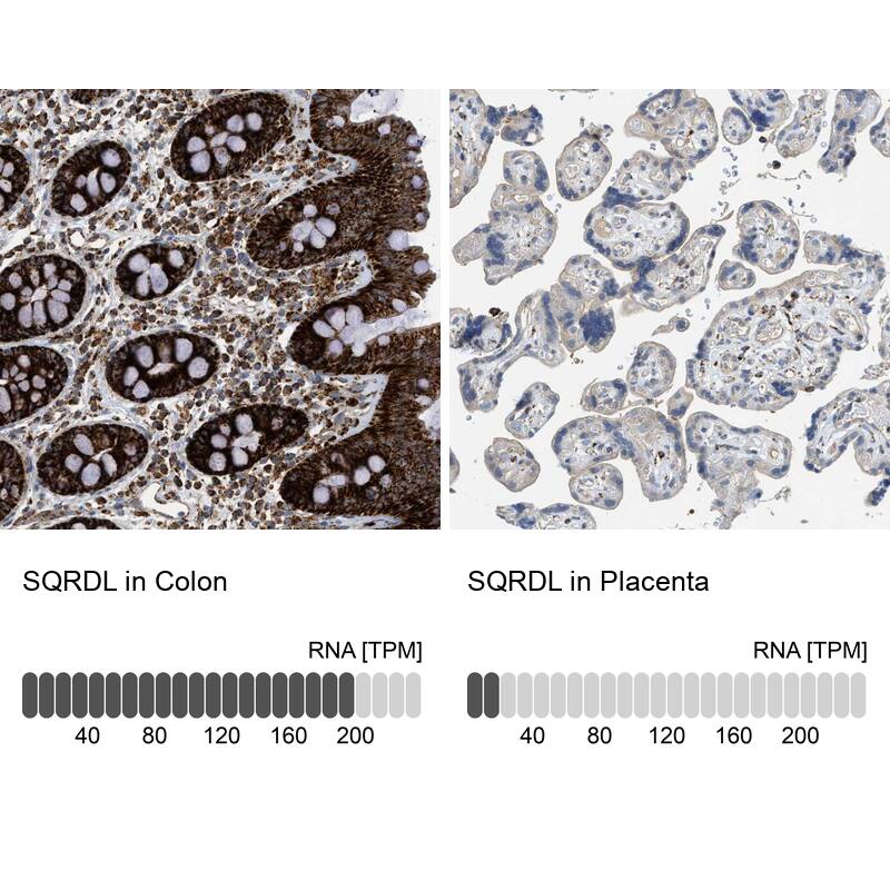 Analysis in human colon and placenta tissues. Corresponding RNA-seq data are presented for the same tissues.