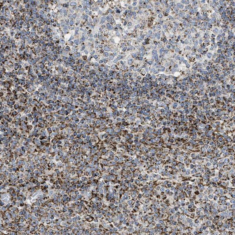 Staining of human lymphoid tissues shows strong positivity in cytoplasm granular in non-germinal center cells.