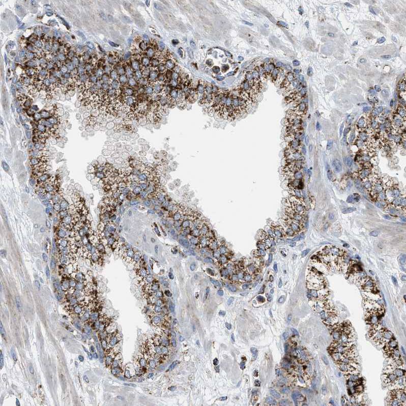 Staining of human prostate shows strong granular cytoplasm positivity in glandular cells.