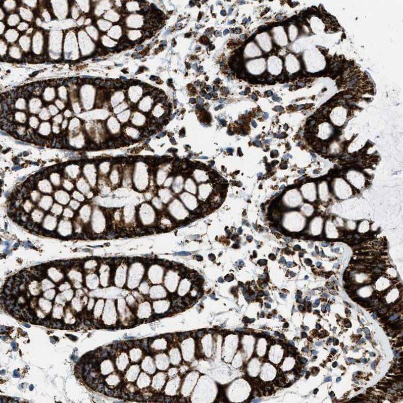 Staining of human rectum shows strong granular cytoplasm positivity in glandular cells.