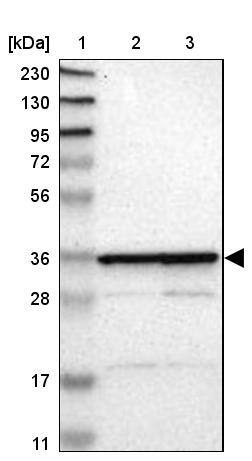 Lane 1: Marker [kDa] 230, 130, 95, 72, 56, 36, 28, 17, 11Lane 2: Human cell line RT-4Lane 3: Human cell line U-251MG sp