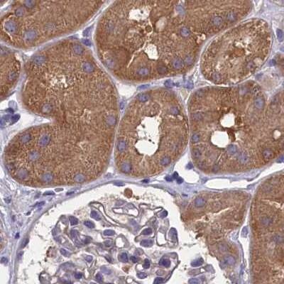 Staining of human kidney.