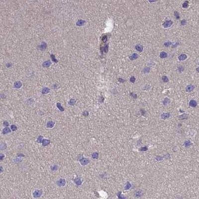 Staining of human cerebral cortex.