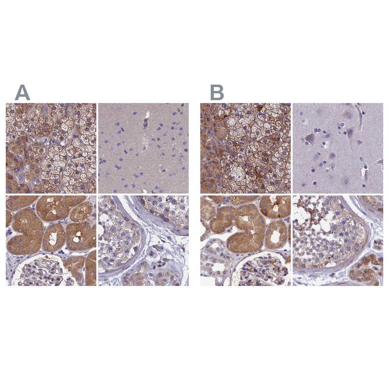 <b>Orthogonal Strategies Validation. </b>Staining of human adrenal gland, cerebral cortex, kidney and testis HPA041321 (A) shows similar protein distribution across tissues to independent antibody HPA041184 (B).