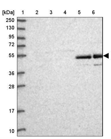 Lane 1: Marker [kDa] 250, 130, 95, 72, 55, 36, 28, 17, 10Lane 2: Human cell line RT-4Lane 3: Human cell line U-251MG spLane 4: Human plasma (IgG/HSA depleted)Lane 5: Human liver tissueLane 6: Human tonsil tissue