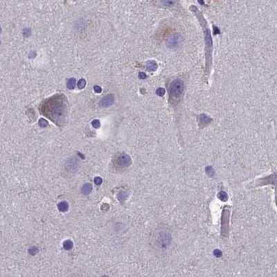 Staining of human cerebral cortex.