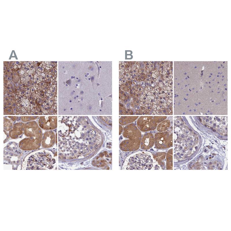<b>Orthogonal Strategies Validation. </b>Staining of human adrenal gland, cerebral cortex, kidney and testis HPA041184 (A) shows similar protein distribution across tissues to independent antibody HPA041321 (B).
