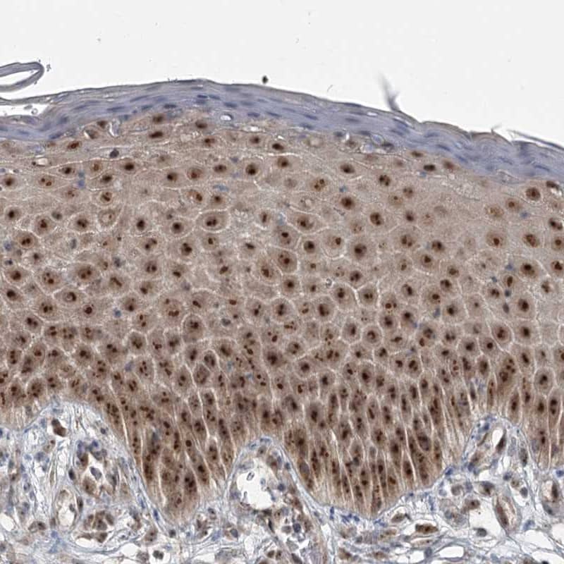 Staining of human vulva/anal skin shows strong nucleolar positivity in squamous epithelial cells.