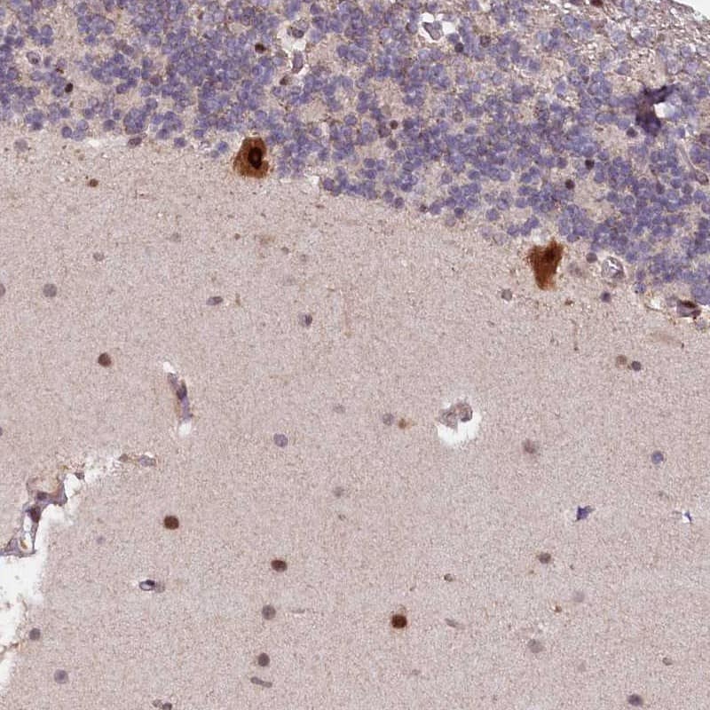 Staining of human cerebellum shows strong cytoplasmic and nuclear positivity in Purkinje cells.