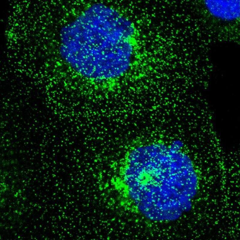 Staining of human cell line A-431 shows localization to plasma membrane & vesicles.