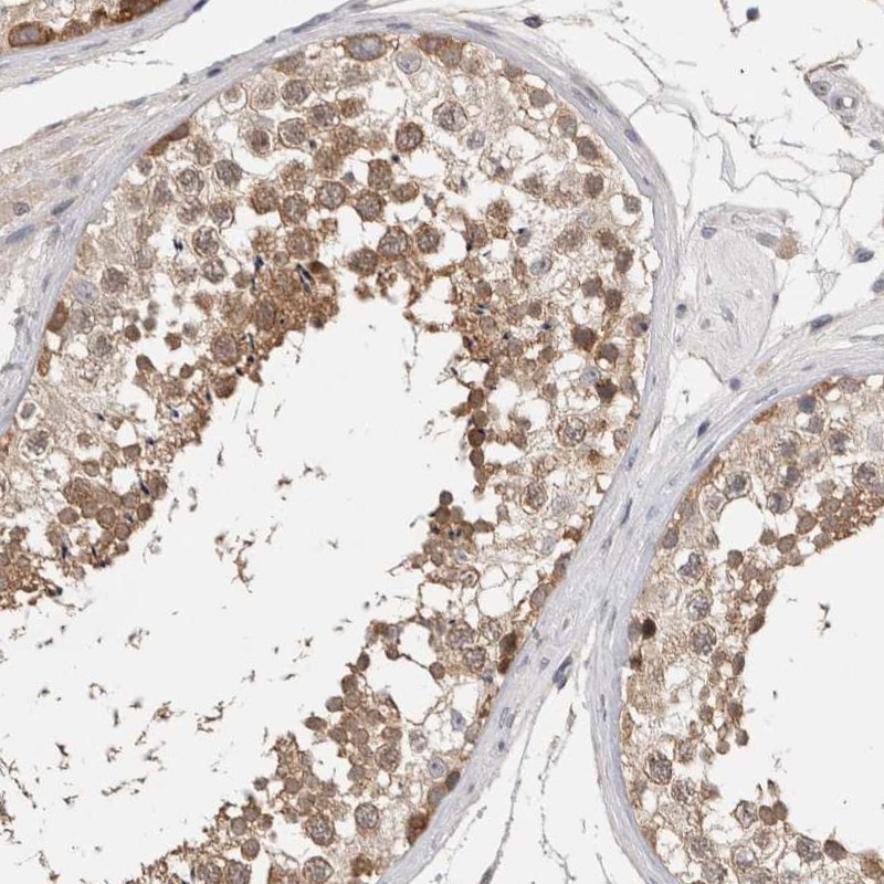 Staining of human testis shows moderate cytoplasmic positivity in cells in seminiferous ducts.