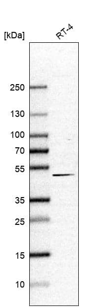 Analysis in human cell line RT-4.