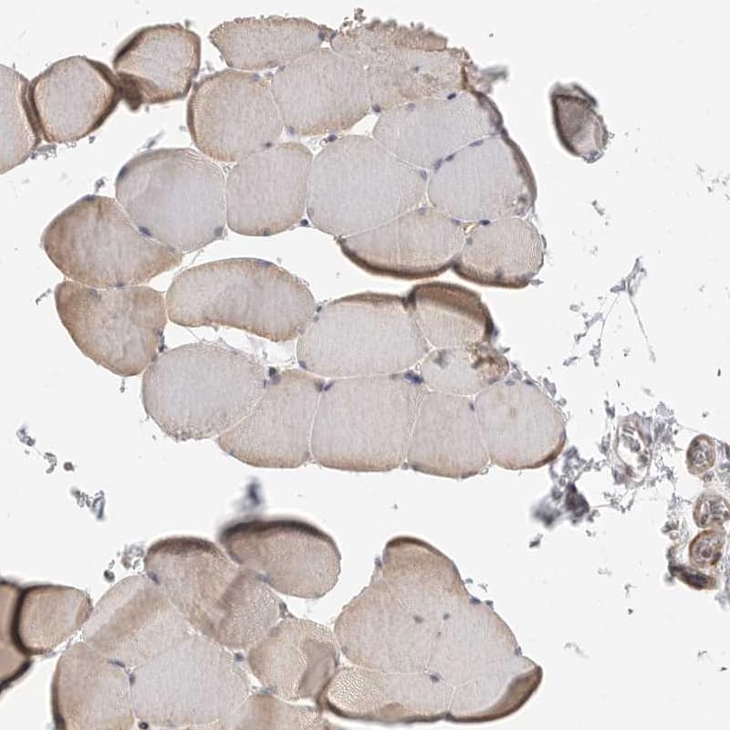 Staining of human skeletal muscle shows only weak cytoplasmic positivity in striated muscle fibers as expected.
