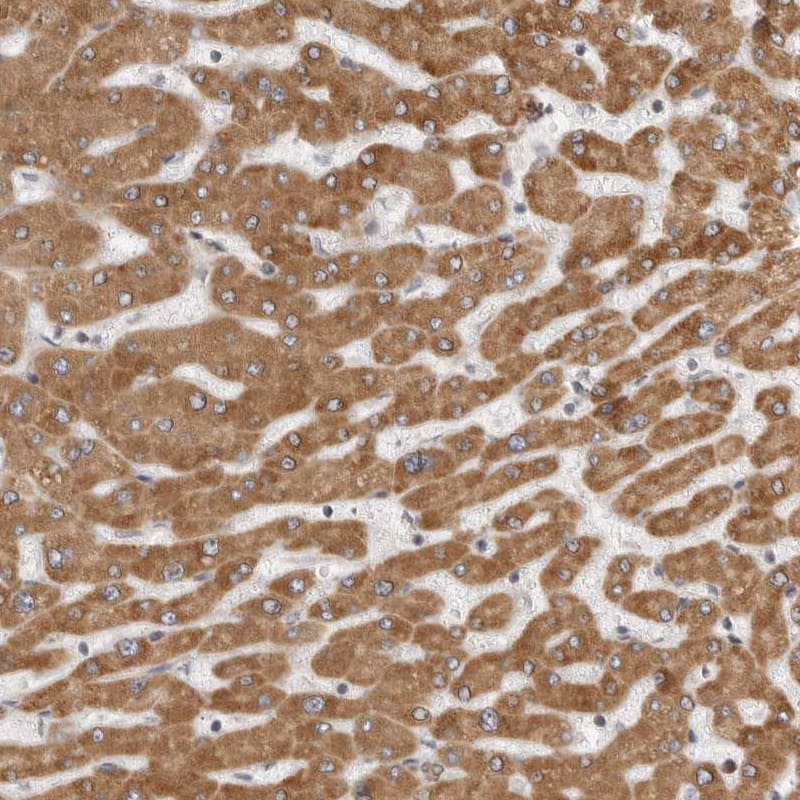 Staining of human liver shows moderate to strong granular cytoplasmic positivity in hepatocytes.