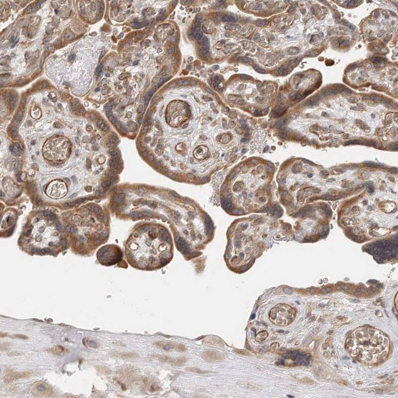 Staining of human placenta shows moderate cytoplasmic positivity in trophoblastic cells.