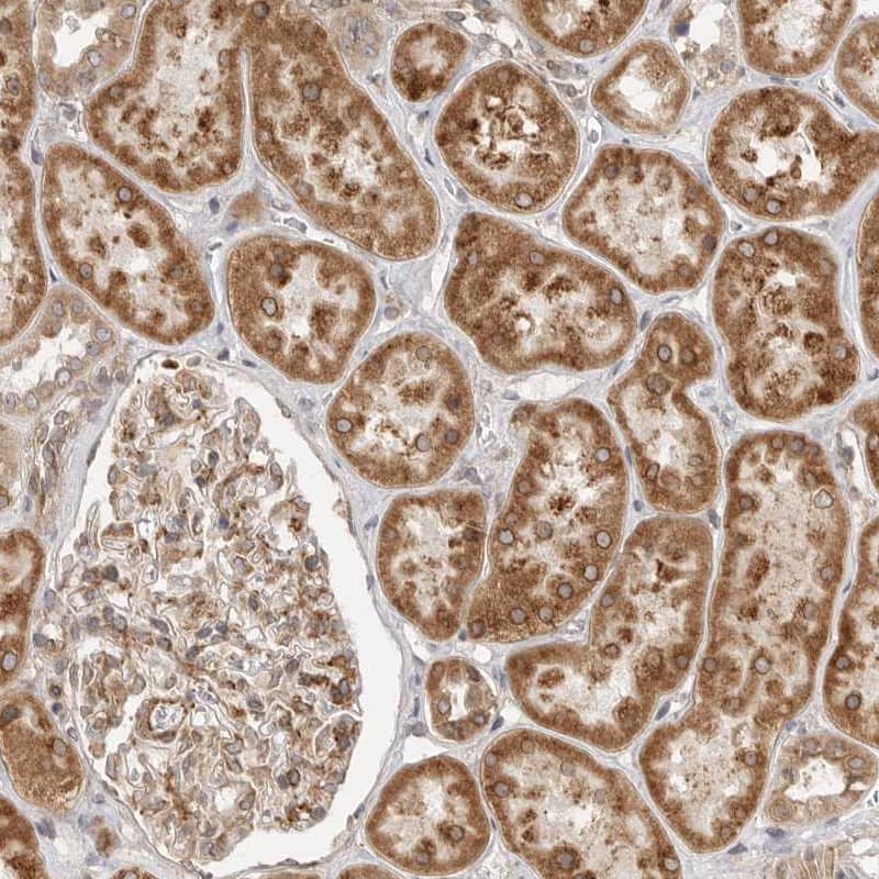Staining of human kidney shows moderate to strong granular cytoplasmic positivity in cells in tubules.