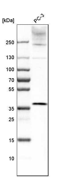 Analysis in human cell line PC-3.