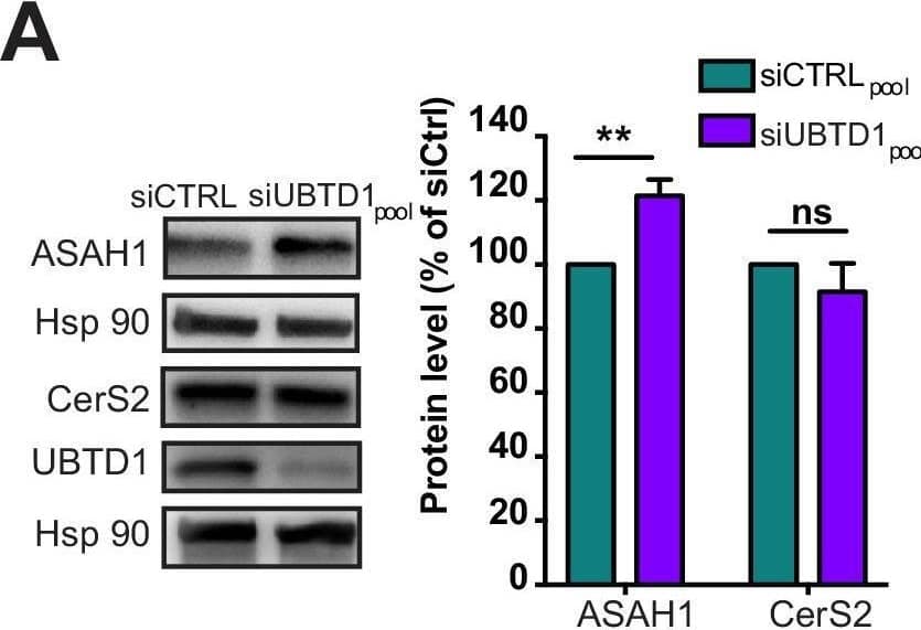 UBTD1 controls ASAH1 ubiquitination to promote EGFR self-phosphorylation.(A–D) DU145 cells were transfected for 48 hr with the indicated siRNA (siCTRLpool or siUBTD1pool or siUBTD1single1 or single2 or siASAH1 single1 or single2). (A) Immunoblot and quantification of ceramide synthase 2 (CerS2) and the lysosomal ceramidase (ASAH1). (B) Immunoblots (up) and quantification (down) of ASAH1 levels in cells treated with cycloheximide (CHX) at different time points. Immunoblot of UBTD1 shows the level of siRNA depletion. CHC was used as a loading control. (C) Immunoblots show ASAH1 ubiquitylation in HEK cells in different experimental conditions. Cells were transfected, as indicated, with expression vectors for histidine-tagged ubiquitin (His-Ub) together with control siRNA or UBTD1 siRNA. His-Ub crosslinked forms of ASAH1 were purified (IP: His) and the immunoblot of ASAH1 showed ASAH1 ubiquitylation. The immunoblot of ASAH1 (bottom panel) was performed in parallel to verify the amounts of ASAH1 protein engaged in His-Ub purifications. The immunoblot of UBTD1 shows the level of siRNA depletion. (D) Immunoblot and quantification of p-EGFR (Y1068 or Y1086) and p-STAT3. p-STAT3, p-ERK and p-AKT levels were quantified by calculating the ratio between phospho-protein and total-protein, both normalized to loading control signal. Immunoblot of UBTD1 shows the level of siRNA depletion. n ≥ 3 independent experiments; ns = non-significant, **p<0.01, ***p<0.001; ****p<0.0001; (A,D) two-way ANOVA and Bonferroni’s multiple comparisons test; data are mean +/- s.e.m.Figure 3—source data 1.Uncropped western blot for Figure 3.Figure 3—source data 2.Row data for Figure 3.Uncropped western blot for Figure 3.Row data for Figure 3. Image collected and cropped by CiteAb from the following open publication (//pubmed.ncbi.nlm.nih.gov/33884955), licensed under a CC-BY license. Not internally tested by Novus Biologicals.