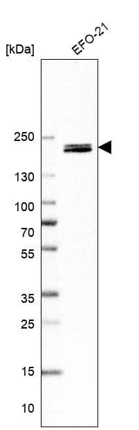 Analysis in human cell line EFO-21.
