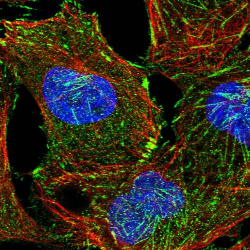 Staining of human cell line U-2 OS shows localization to actin filaments & focal adhesion sites.