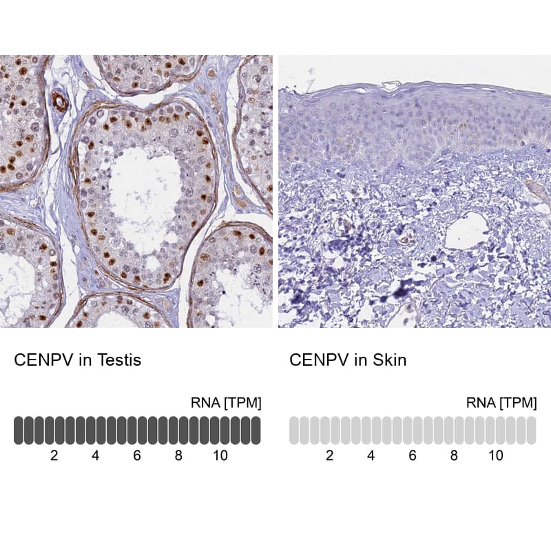 Immunohistochemistry-Paraffin CENPV Antibody - BSA Free