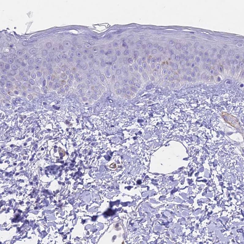 Immunohistochemistry-Paraffin CENPV Antibody - BSA Free