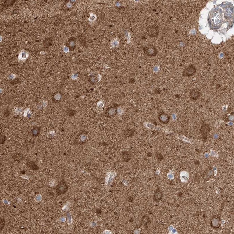 Staining of human cerebral cortex shows moderate cytoplasmic positivity in neuronal cells.