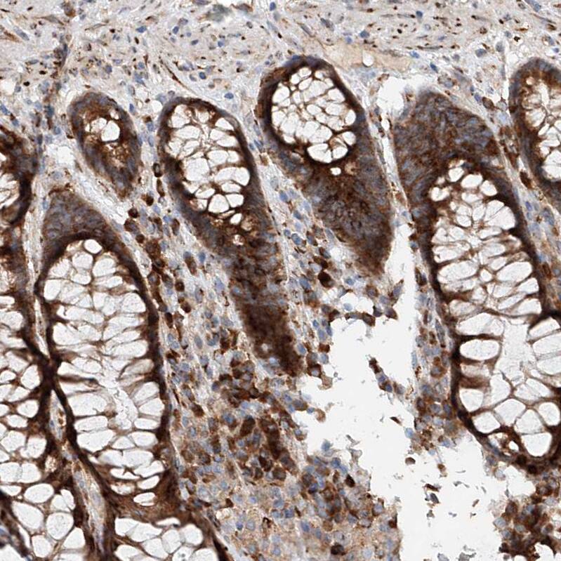 Staining of human rectum shows strong cytoplasmic positivity in glandular cells.