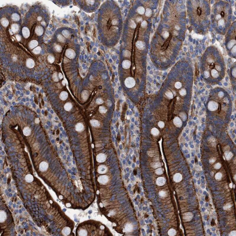 Staining of human duodenum shows strong membranous and cytoplasmic positivity in glandular cells.