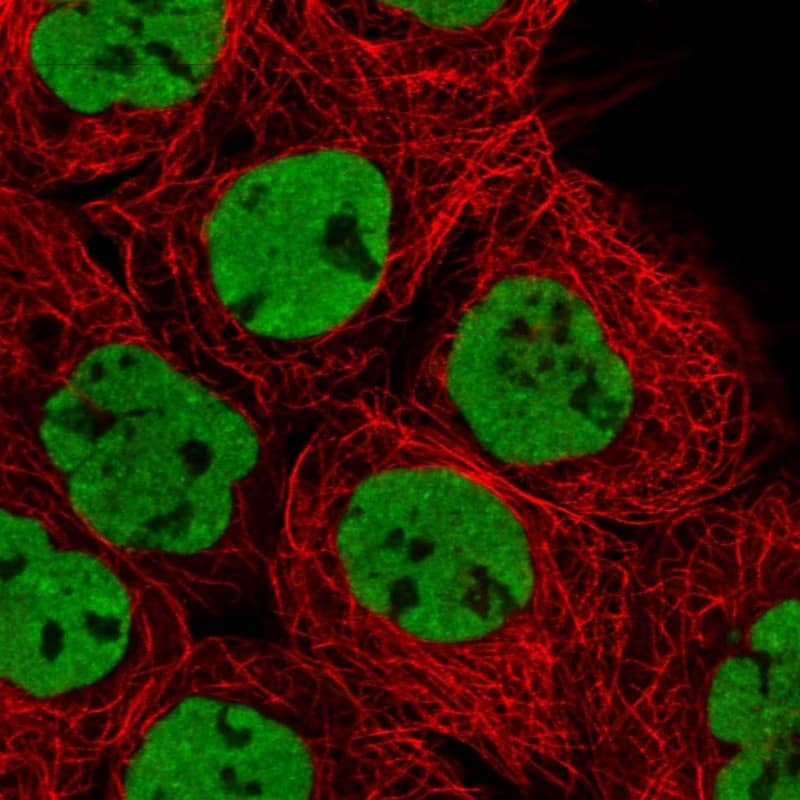 Staining of human cell line A-431 shows localization to nucleoplasm.