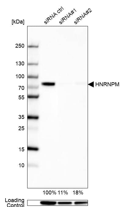 <b>Genetic Strategies Validation. </b>Analysis in U2OS cells transfected with control siRNA, target specific siRNA probe #1 and #2, using Anti-HNRNPM antibody. Remaining relative intensity is presented. Loading control: Anti-GAPDH.