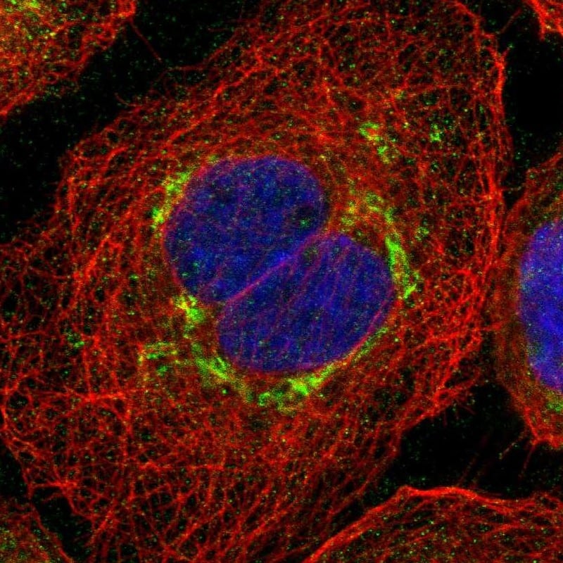 Staining of human cell line A-431 shows localization to the Golgi apparatus.