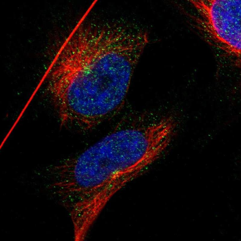 Immunocytochemistry/ Immunofluorescence IFT81 Antibody - BSA Free