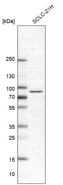 Analysis in human cell line SCLC-21H.
