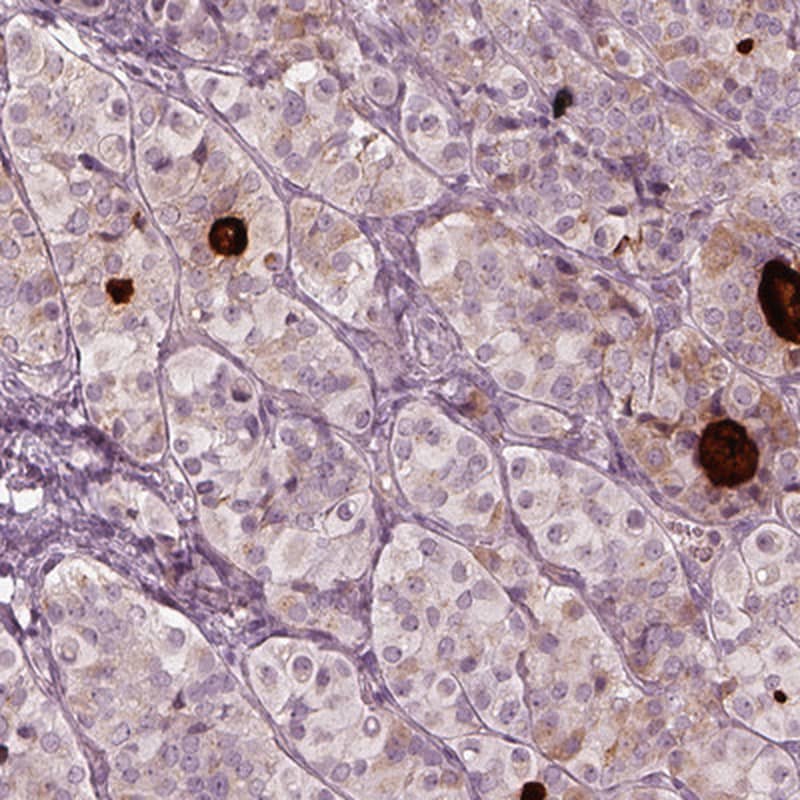 Immunohistochemistry-Paraffin RAB4B Antibody