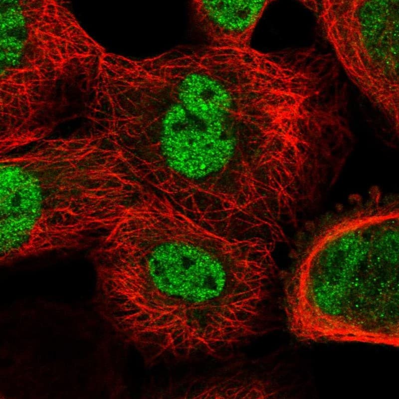 Staining of human cell line A-431 shows localization to nucleoplasm.