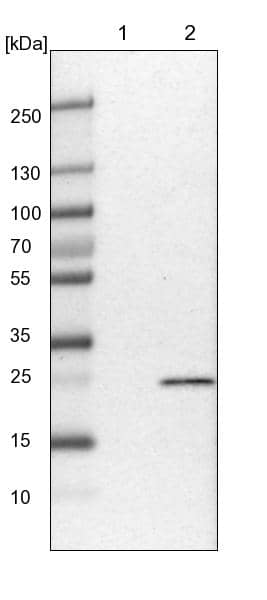 Lane 1: NIH-3T3 cell lysate (Mouse embryonic fibroblast cells)Lane 2: NBT-II cell lysate (Rat Wistar bladder tumour cells)