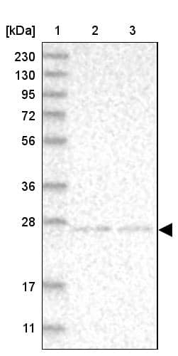 Lane 1: Marker [kDa] 230, 130, 95, 72, 56, 36, 28, 17, 11Lane 2: Human cell line RT-4Lane 3: Human cell line U-251MG sp