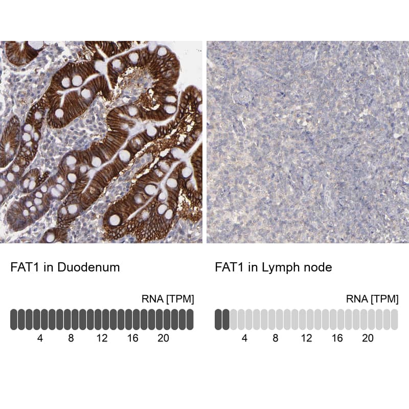 <b>Orthogonal Strategies Validation. </b>Analysis in human duodenum and lymph node tissues using HPA001869 antibody. Corresponding FAT1 RNA-seq data are presented for the same tissues.