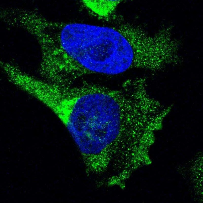 Staining of human cell line U-251 MG shows localization to cytosol & vesicles.