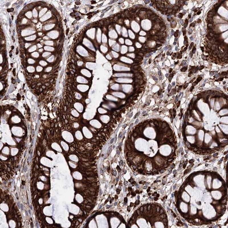 Staining of human rectum shows strong cytoplasmic and membranous positivity in glandular cells.