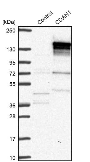 Analysis in control (vector only transfected HEK293T lysate) and CDAN1 over-expression lysate (Co-expressed with a C-terminal myc-DDK tag (~3.1 kDa) in mammalian HEK293T cells, LY408581).
