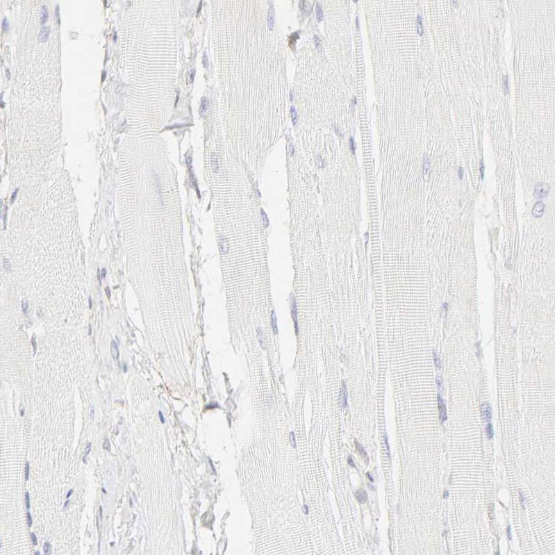 Staining of human skeletal muscle shows no positivity in myocytes as expected.