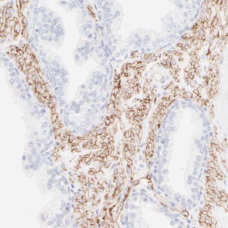 Staining of human prostate shows moderate membranous positivity in smooth muscle cells.